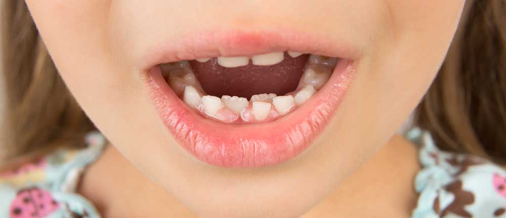 Dientes Tiburon Ninos