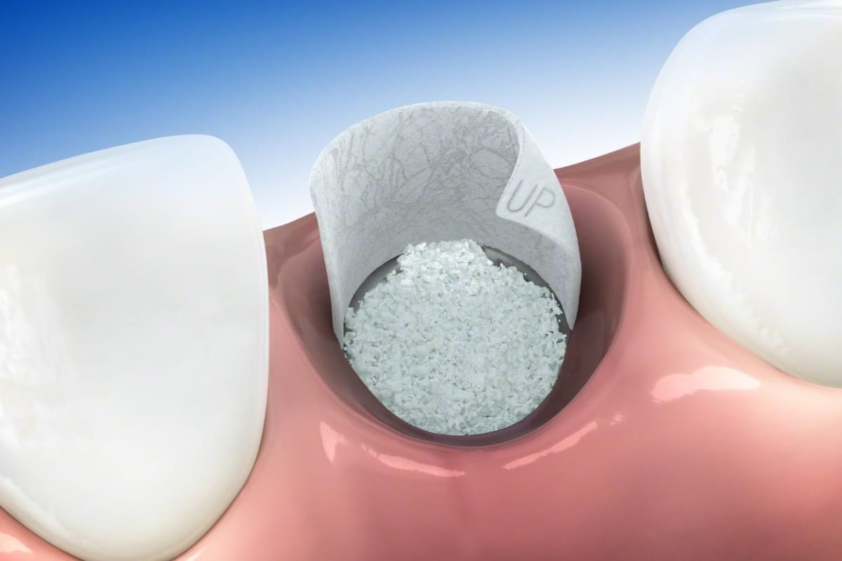 Estetica Dental Regeneracion