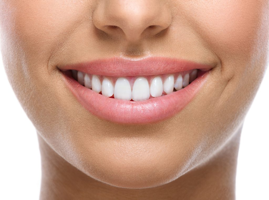 blanqueamiento dental en Granada