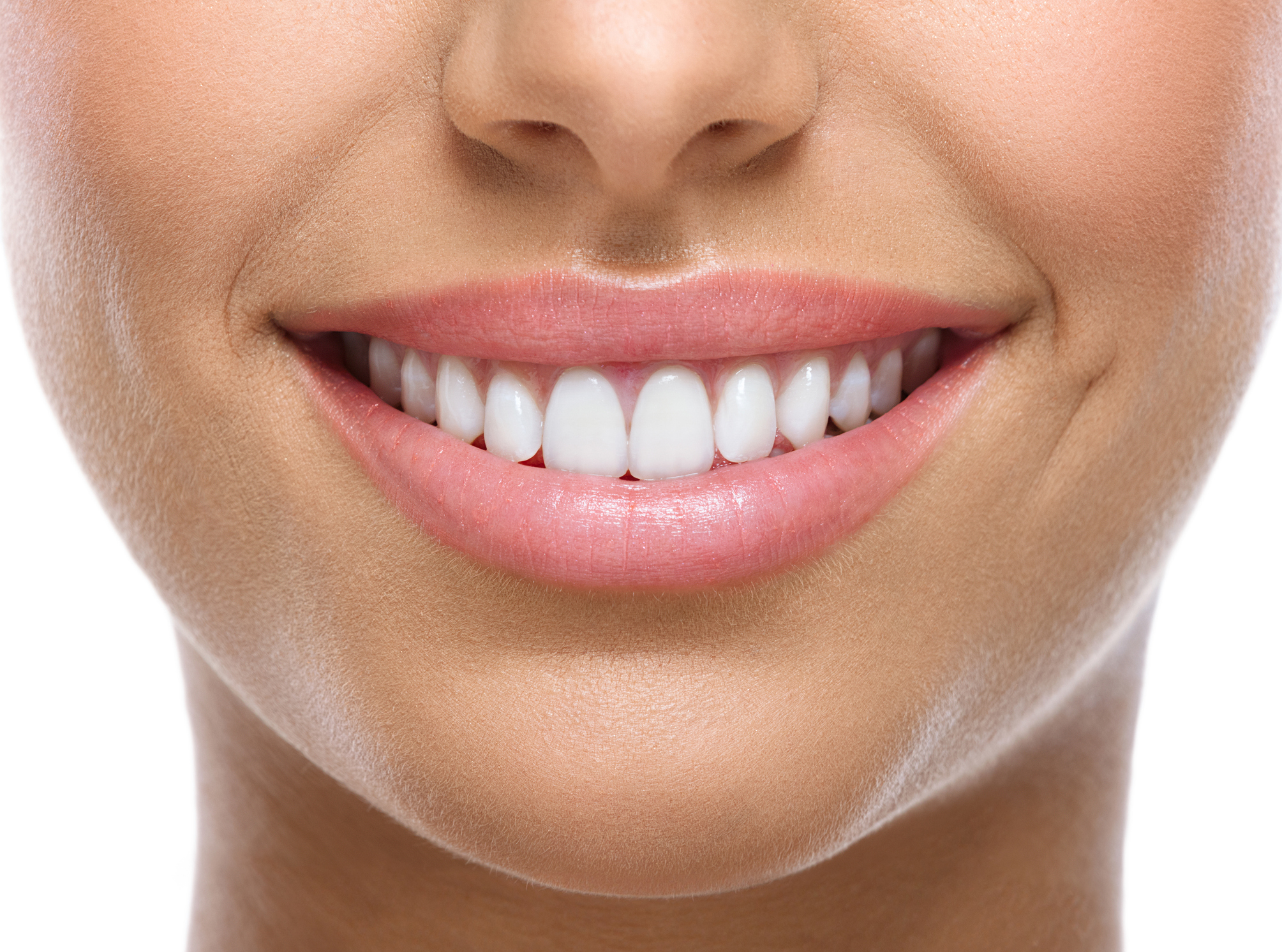 blanqueamiento dental en Granada
