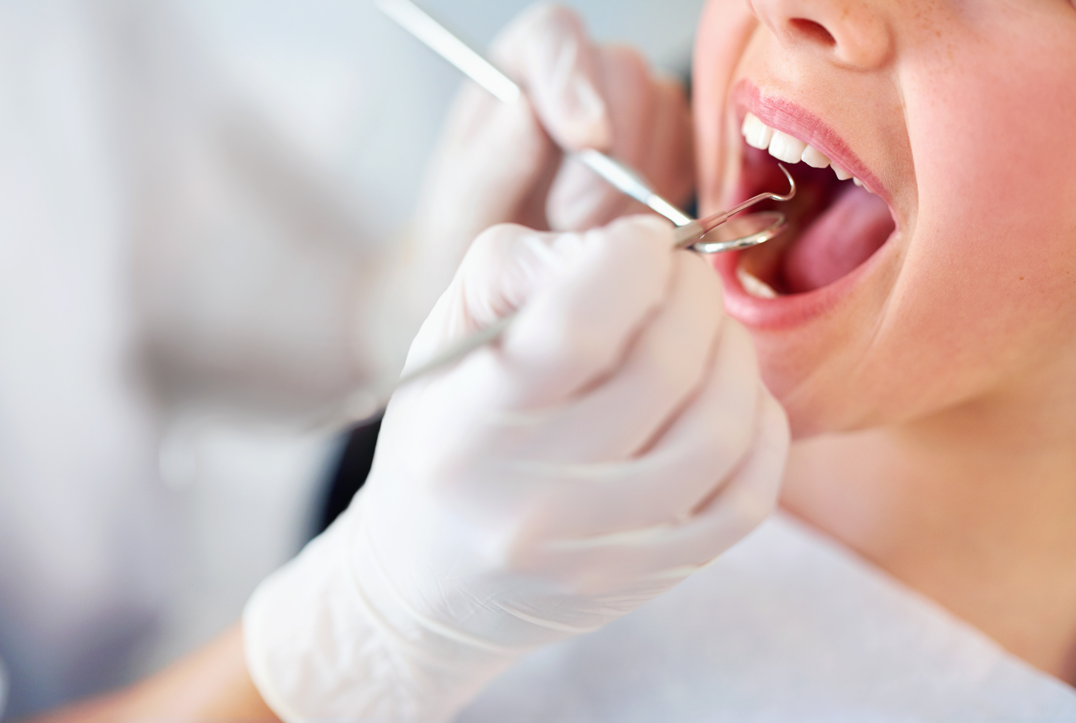 profilaxis dental
