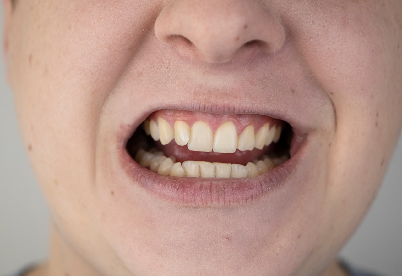 Periodoncia Boca Sana