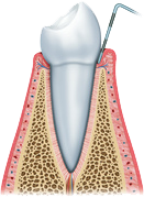 Periodoncia01