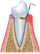 Periodoncia02